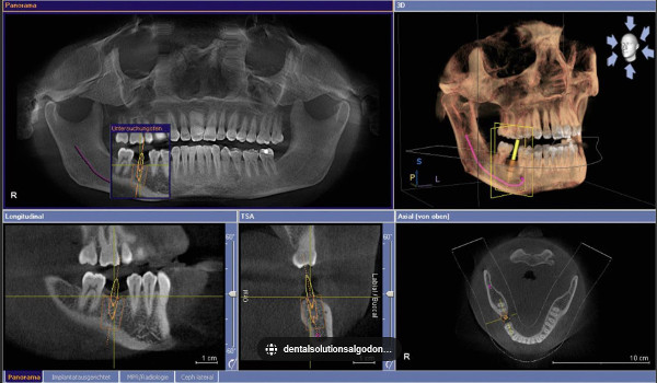 Ct Scan