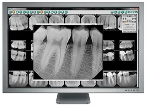 Digital xrays